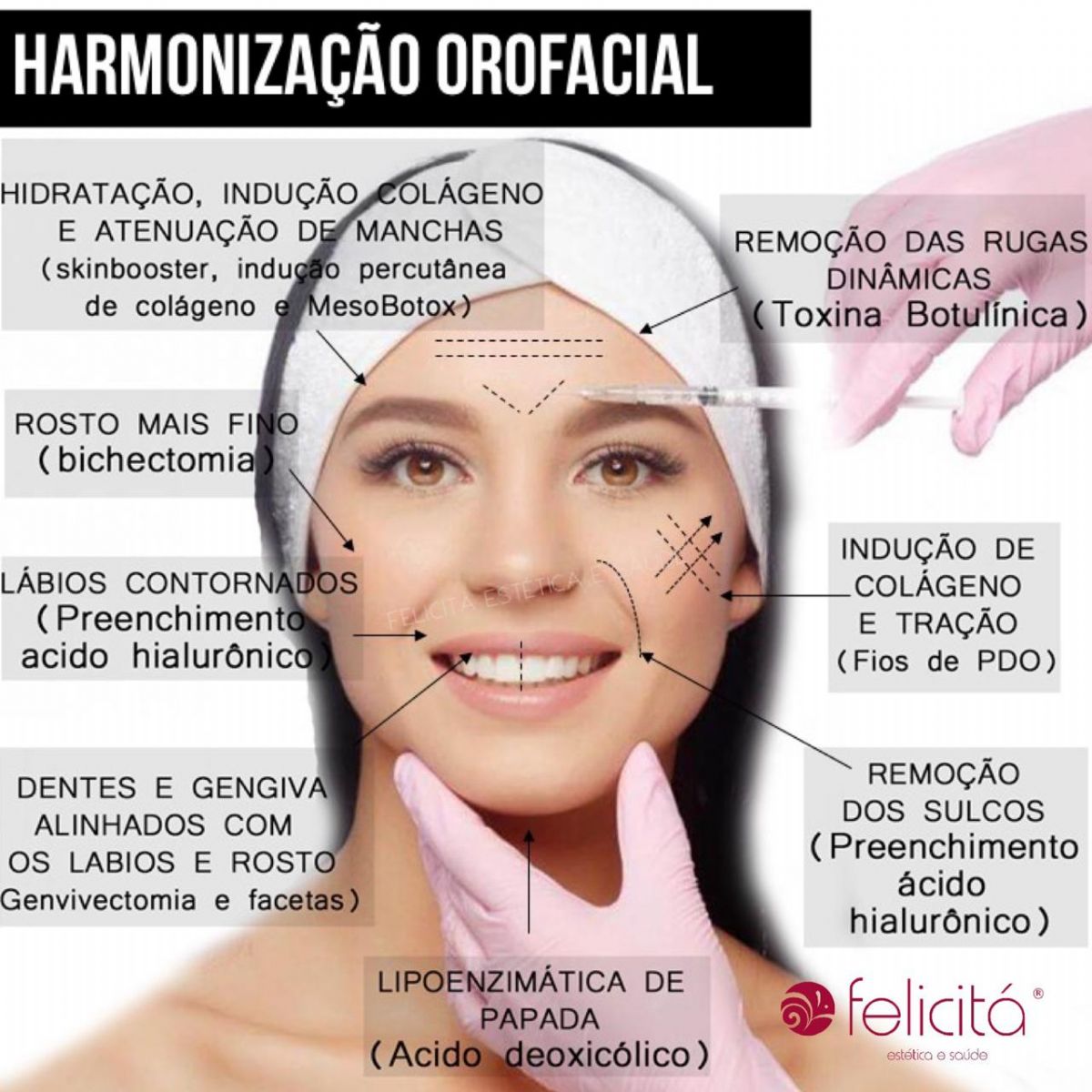 Qual procedimento posso fazer em uma Harmonização Facial?